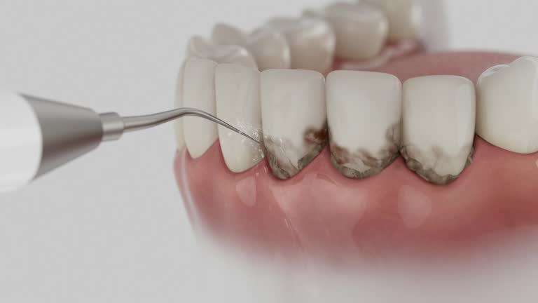 Trusted Wisdom Tooth Removal service in Fairfax, IA - Dentist Open Now